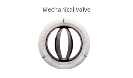 Mechanical valve