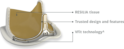 Diagram of INSPIRIS RESILIA aortic valve